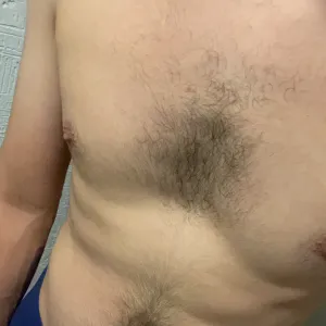 EG501 Onlyfans